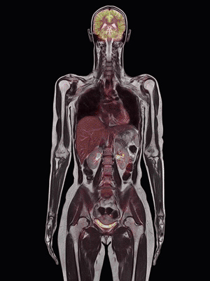 Image: A high-resolution image from the Biograph mMR whole-body MR-PET scanner (Photo courtesy of Siemens Healthcare).